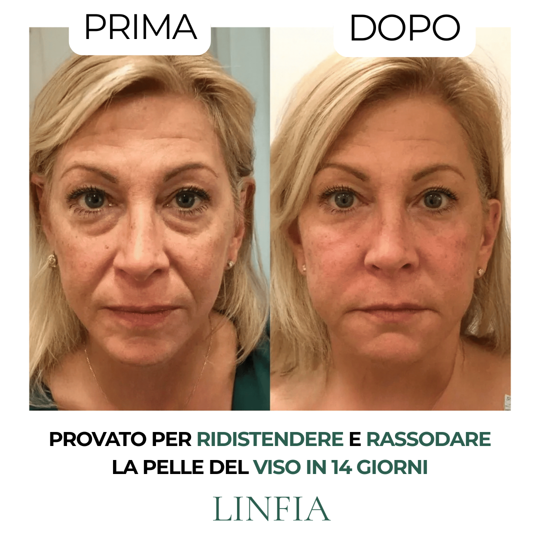 Spazzola per drenaggio linfatico