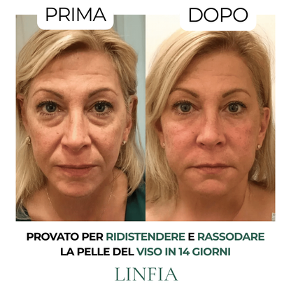 Spazzola per drenaggio linfatico