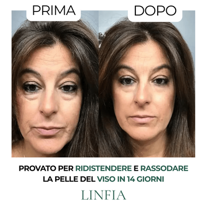 Spazzola per drenaggio linfatico